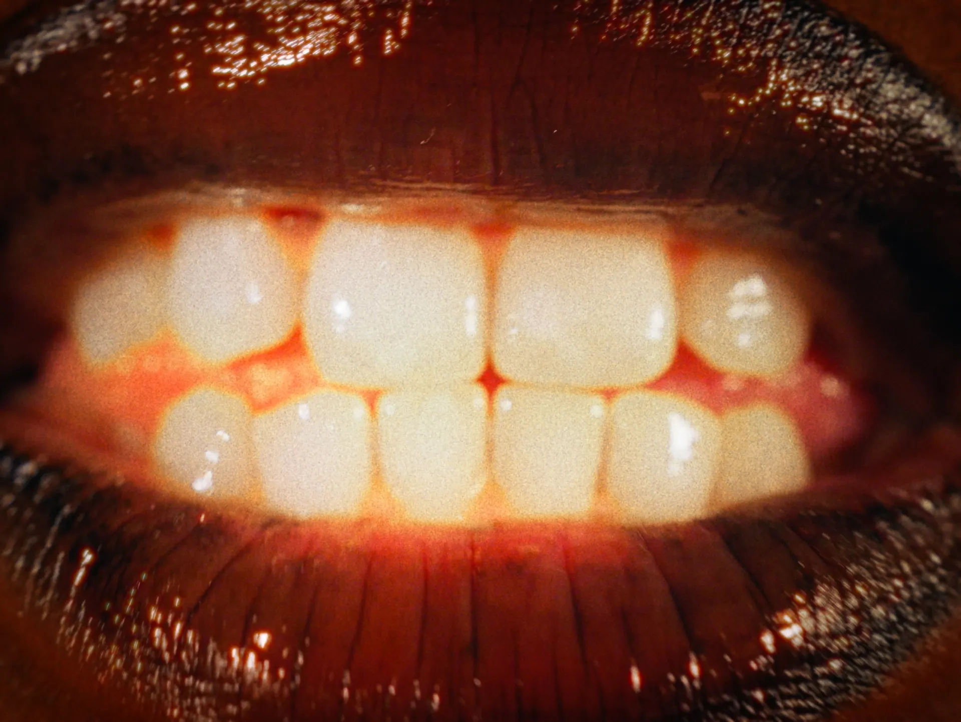 Image 8 sur 12 — Ezek — Haha
